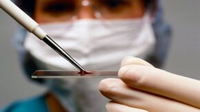 Diagnosi di artrotte e artrosi
